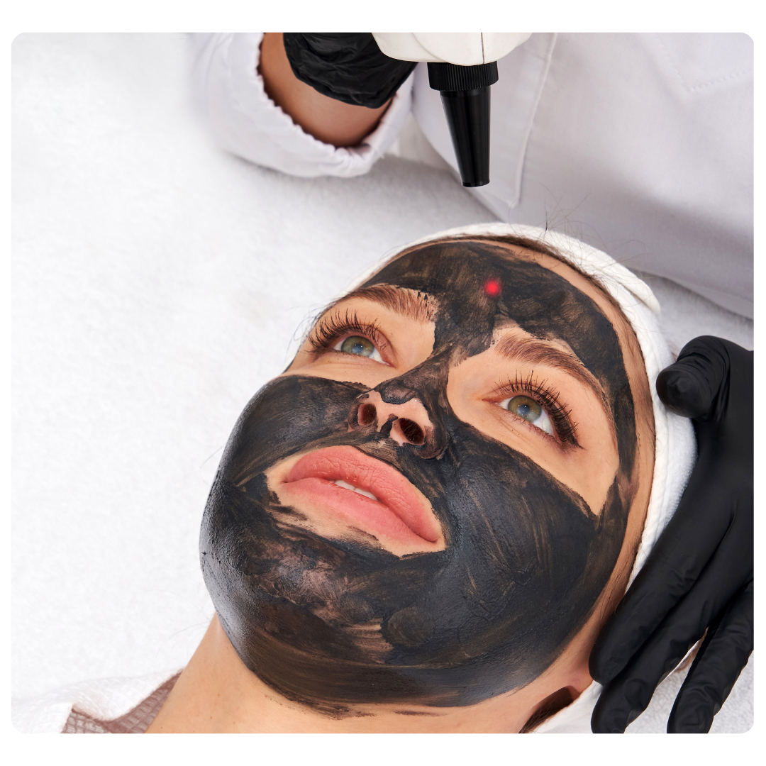 Hollywood Laser Peeling