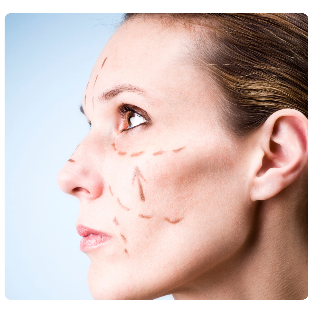 Perfilado de Rostro